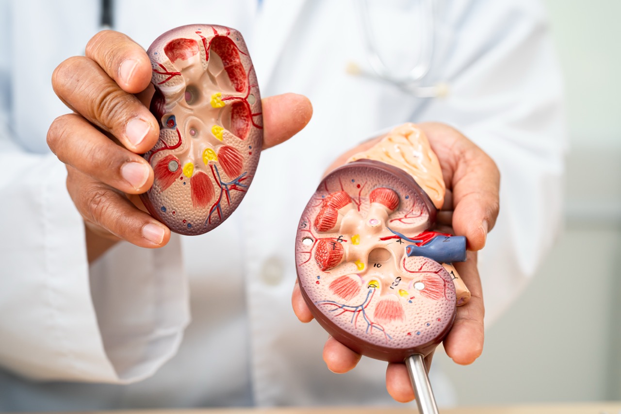 enfermedad renal enfermedad renal cronica ckd el medico tiene un modelo humano para tratar y estudiar en el hospital Large