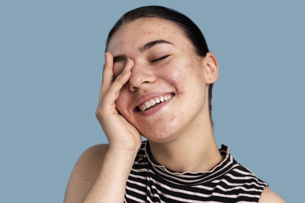 los jovenes y la medicina estetica preventiva